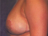 Patient # 38978 After Photo # 2